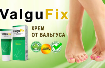ValguFix от косточки на стопе