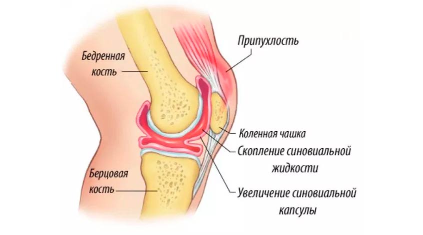 Физическая терапия и упражнения