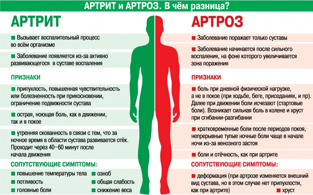 Разновидности отеков при артрите