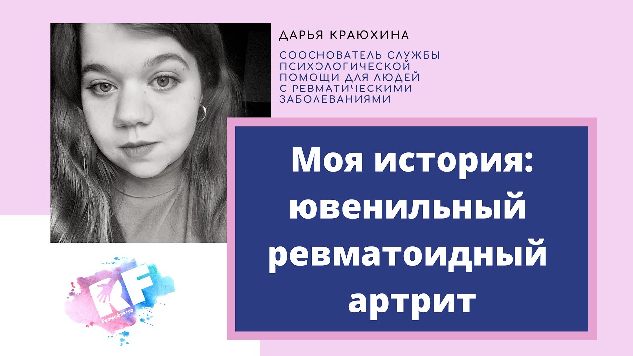 Лечение ювенильного идиопатического артрита: какие методы существуют?