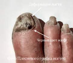 Дерматолог
