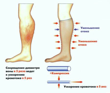 Плохо подобранная обувь