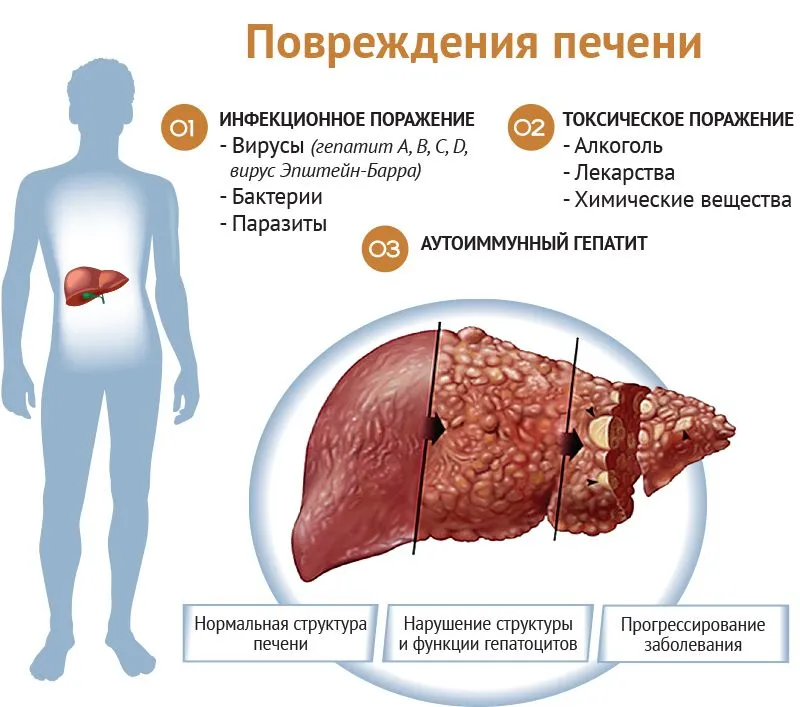 1. Уплотнение и болезненность в области печени