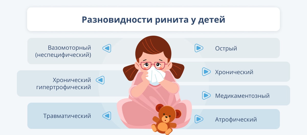 Лечение вирусного насморка