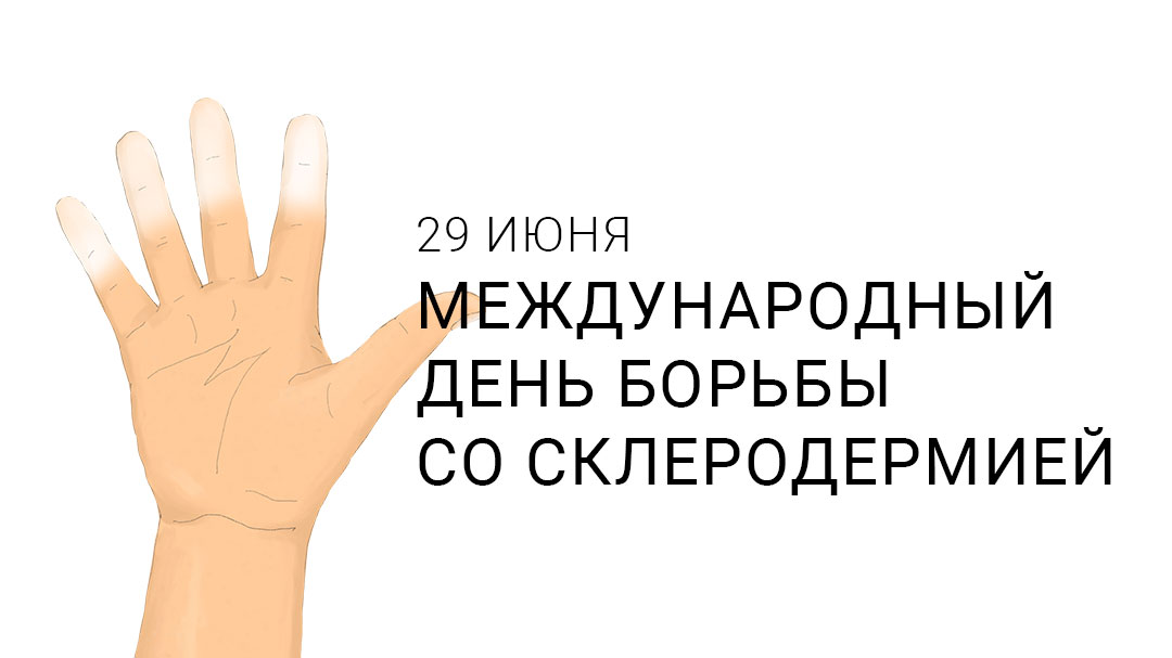 Симптомы склеродермии и их клиническое значение