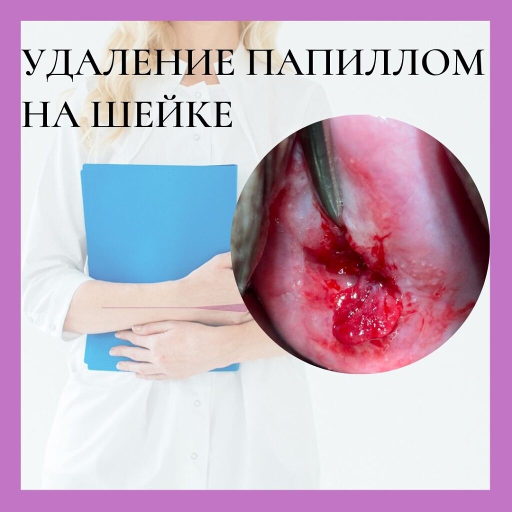 Проведение анализа крови по гинекологии