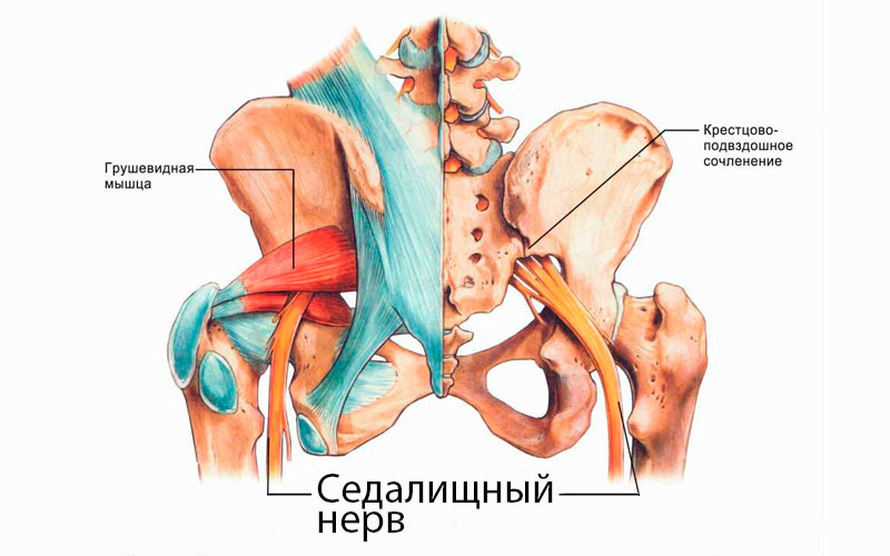 Симптомы седалищного нерва