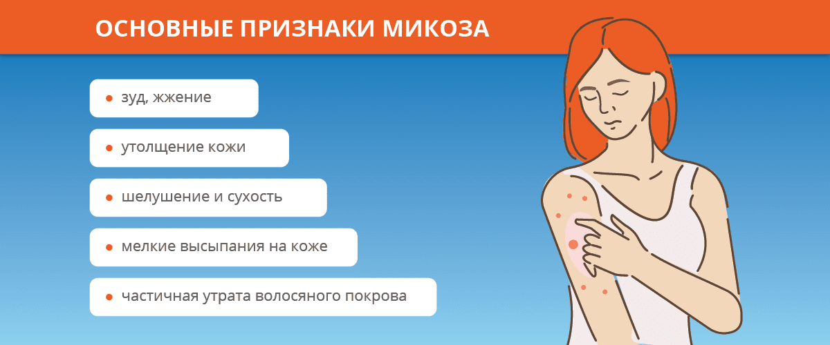 Симптомы грибковой инфекции кожи