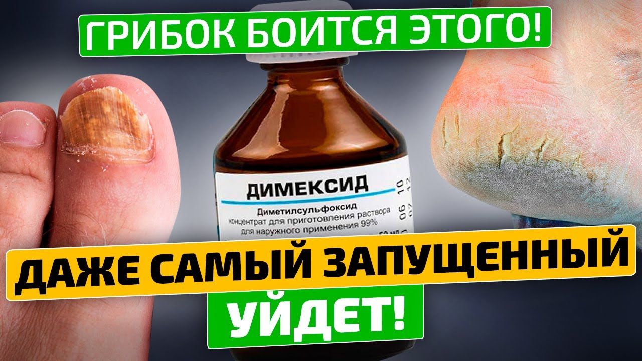Полезные свойства «Димексида»