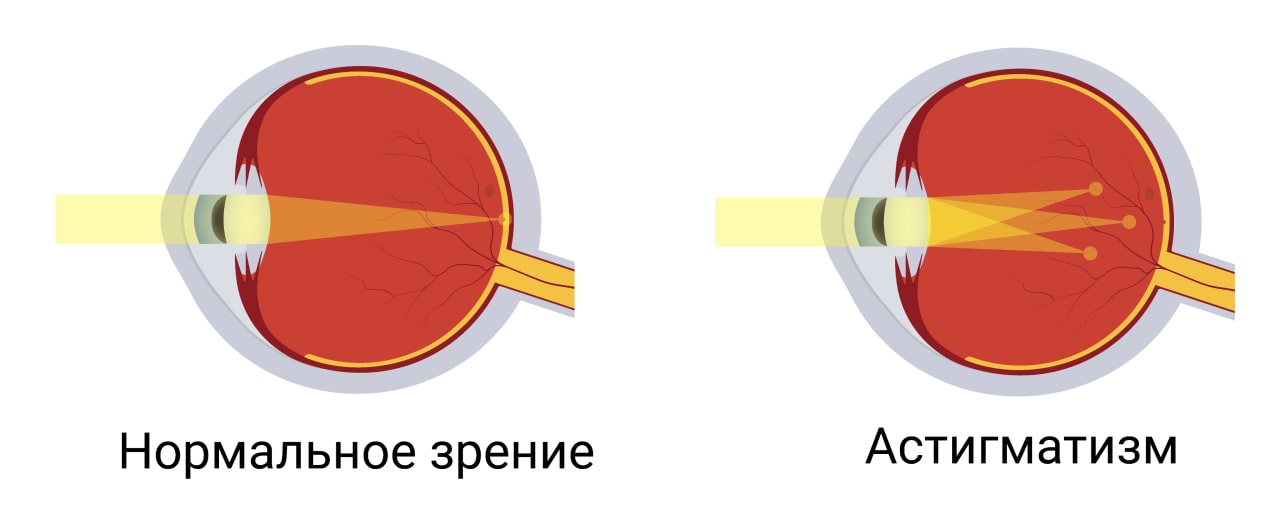 Почему нельзя заниматься самолечением?
