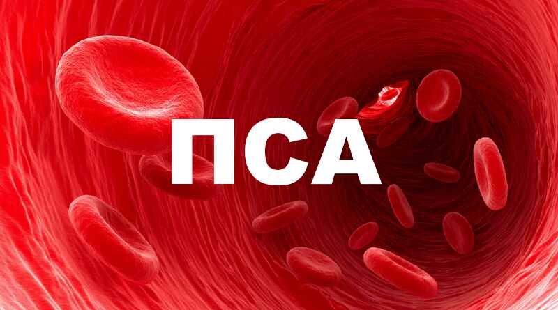 ПСА: диагностика и мониторинг простатического заболевания