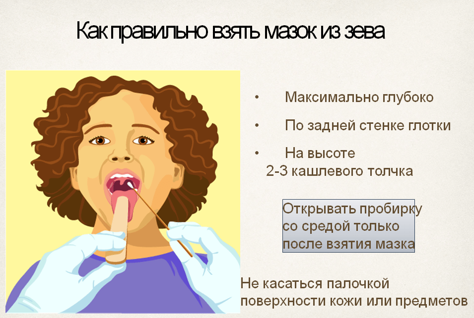 Какие заболевания можно определить с помощью мазка из зева и носа?