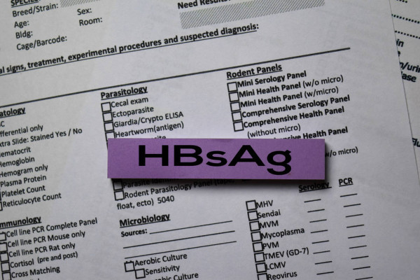 Подготовка к анализу на HBsAg