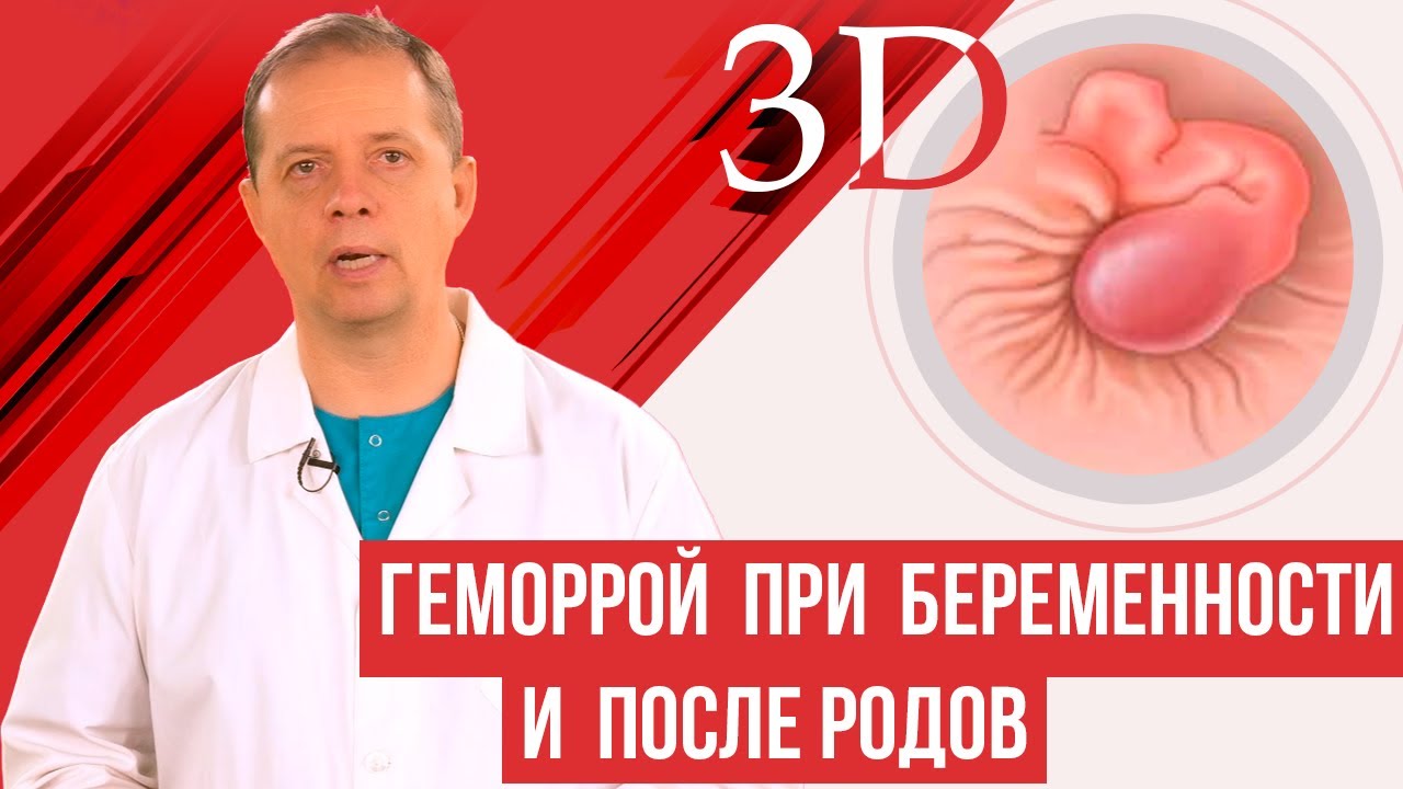 Когда обратиться к врачу?