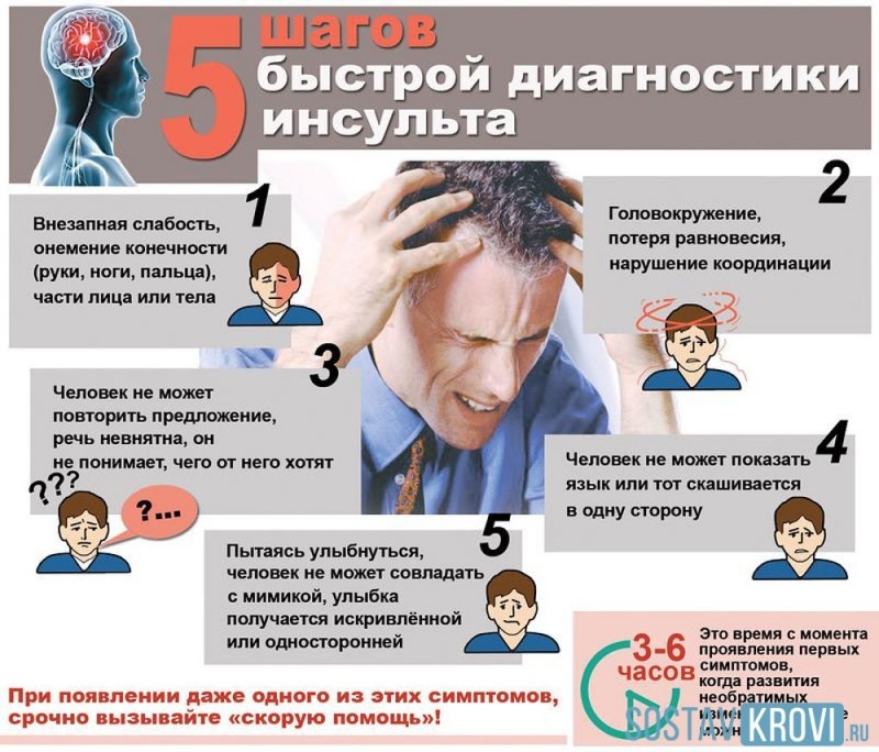 Основные симптомы инсульта