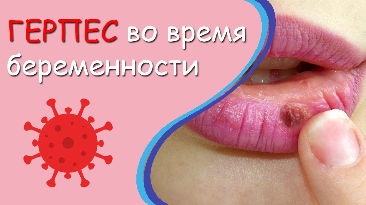 1. Применение противовирусных препаратов