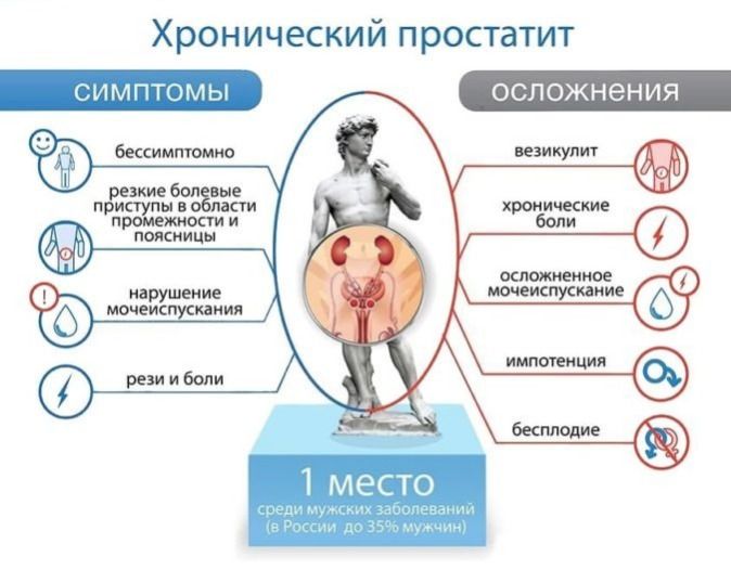 Массаж предстательной железы
