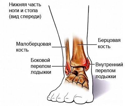 2. Поддерживать ногу в повышенном положении