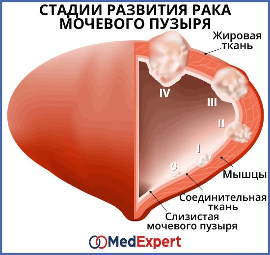 Хирургическое лечение