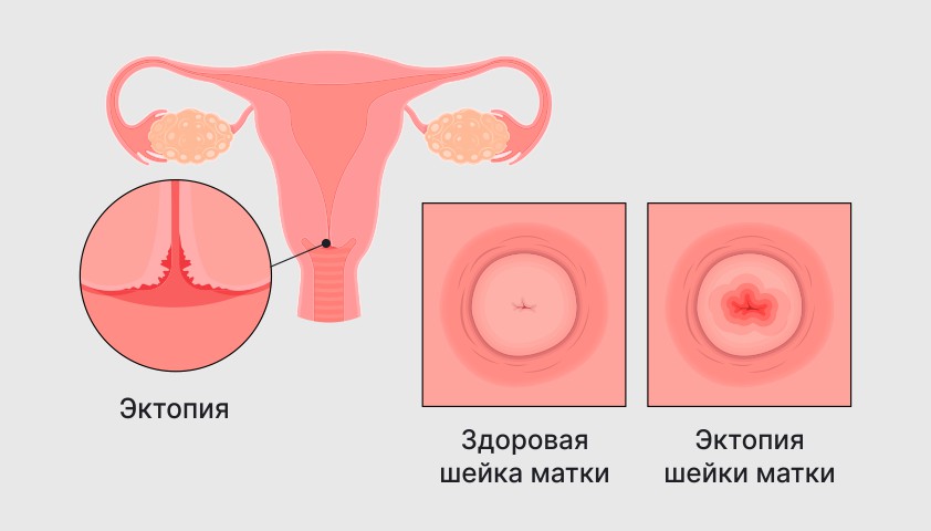 Структура и форма цилиндрического эпителия