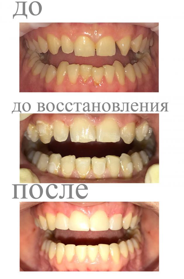 Как работают трейнеры