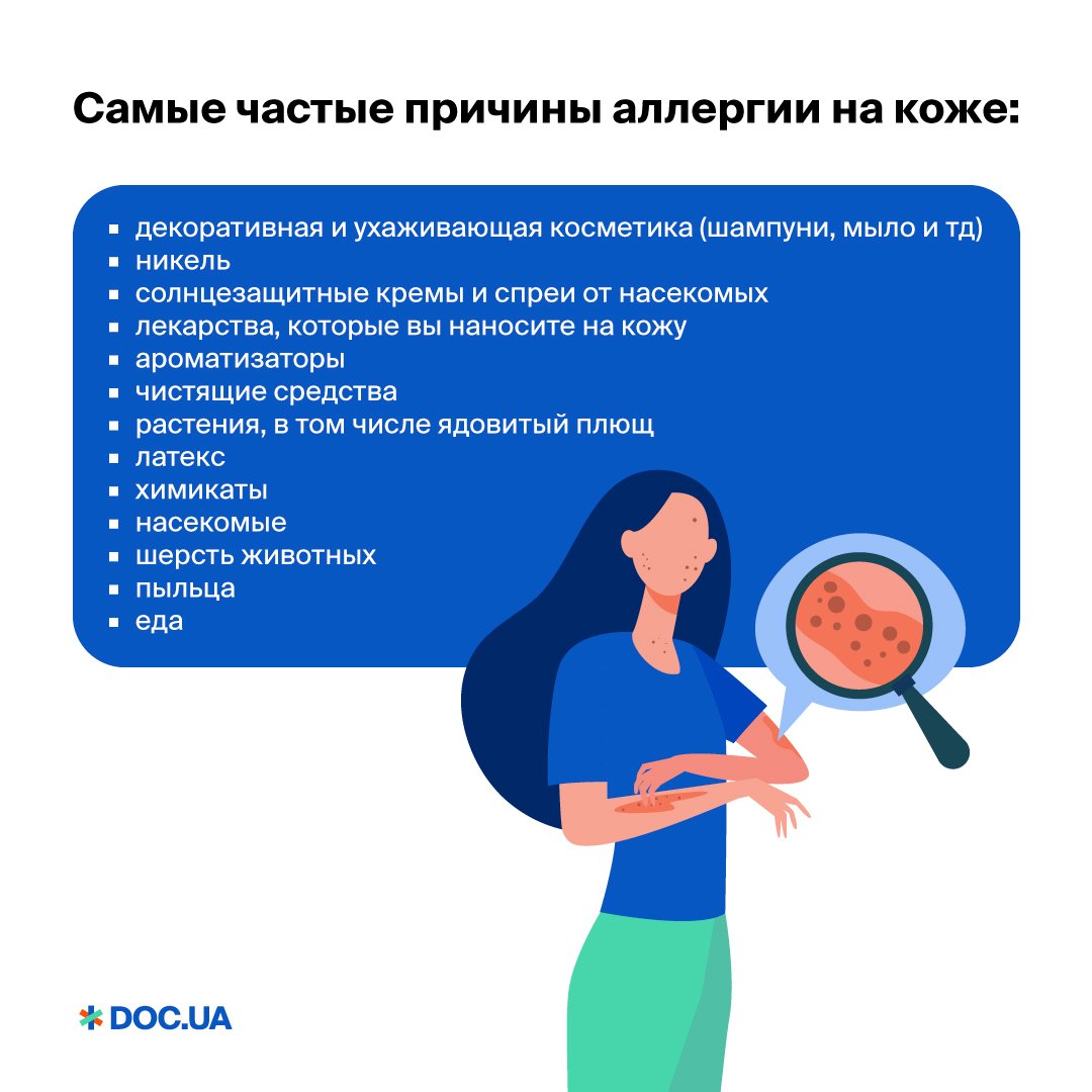 Популярные народные методы лечения ожога крапивой