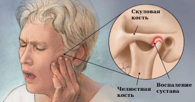 Воспалительные процессы и инфекции в области челюсти