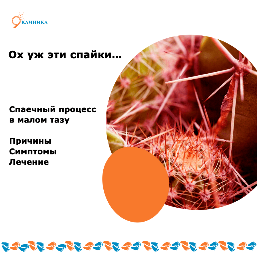Что такое спаечная болезнь брюшной полости?