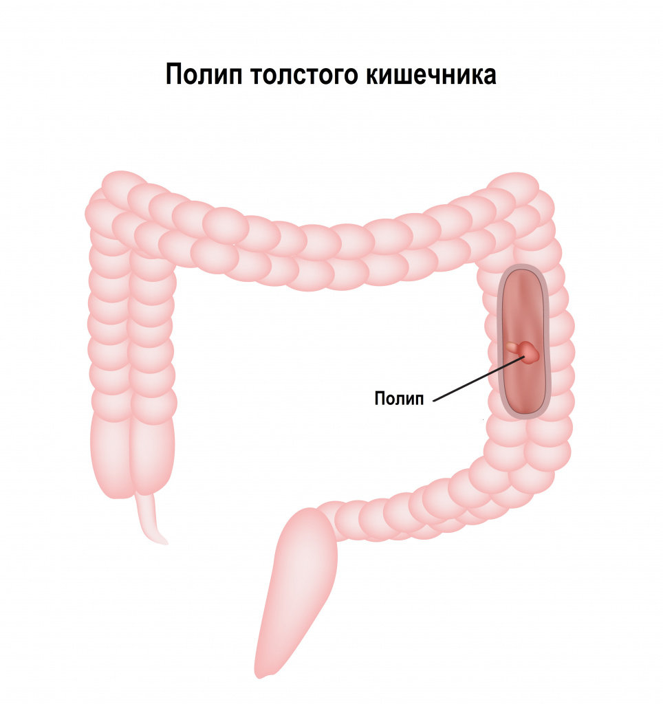 Нарушение гигиены