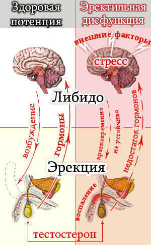 Физические проблемы, приводящие к возникновению импотенции