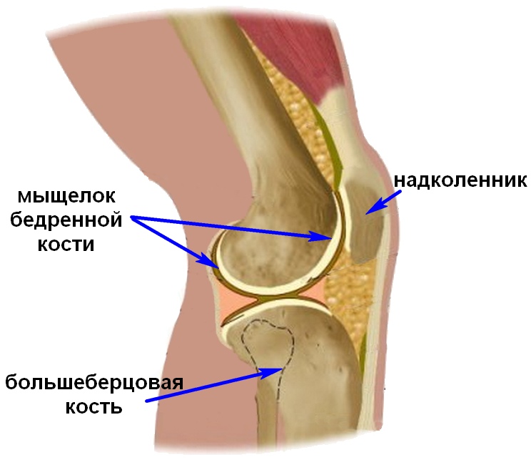 Острые травмы мыщелка коленного сустава