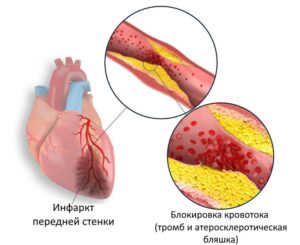 1. Соблюдение здорового образа жизни: