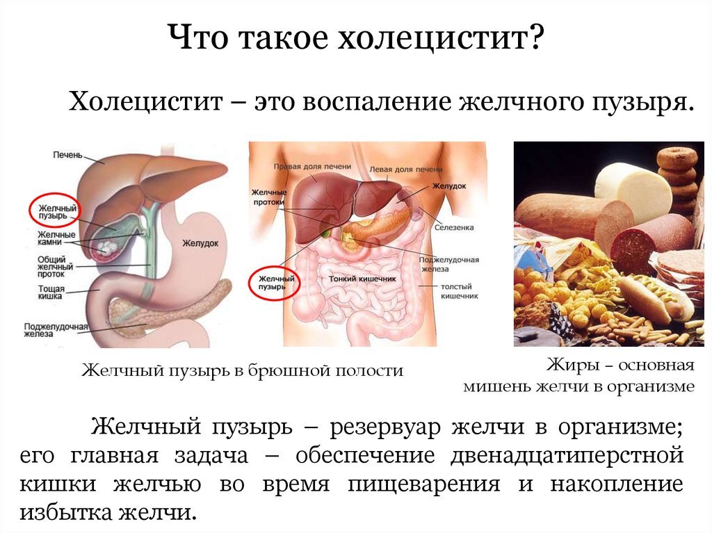 Лекарственные препараты при приступе холецистита