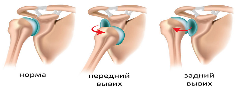Консервативное лечение