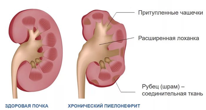 Возможные проблемы для плода