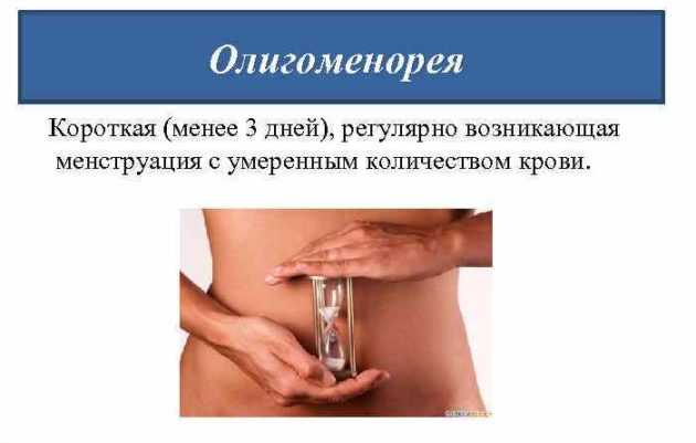 Аномалии менструального цикла
