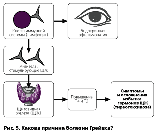 1. Офтальмопатия Грейвса