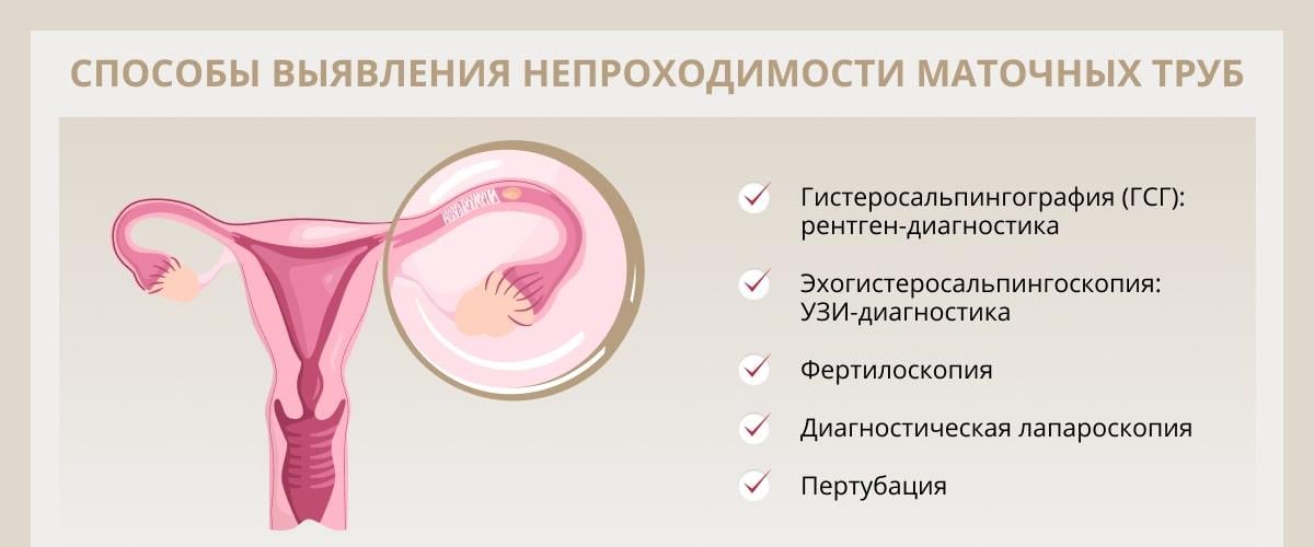 Диета и лечение спаечной болезни брюшной полости: