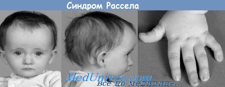 Генетические факторы