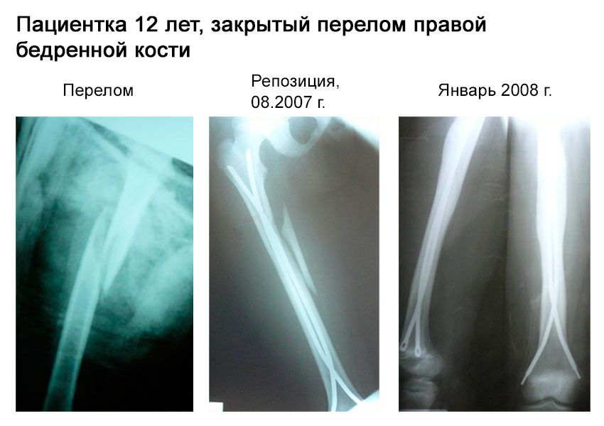 Период после проведения операции