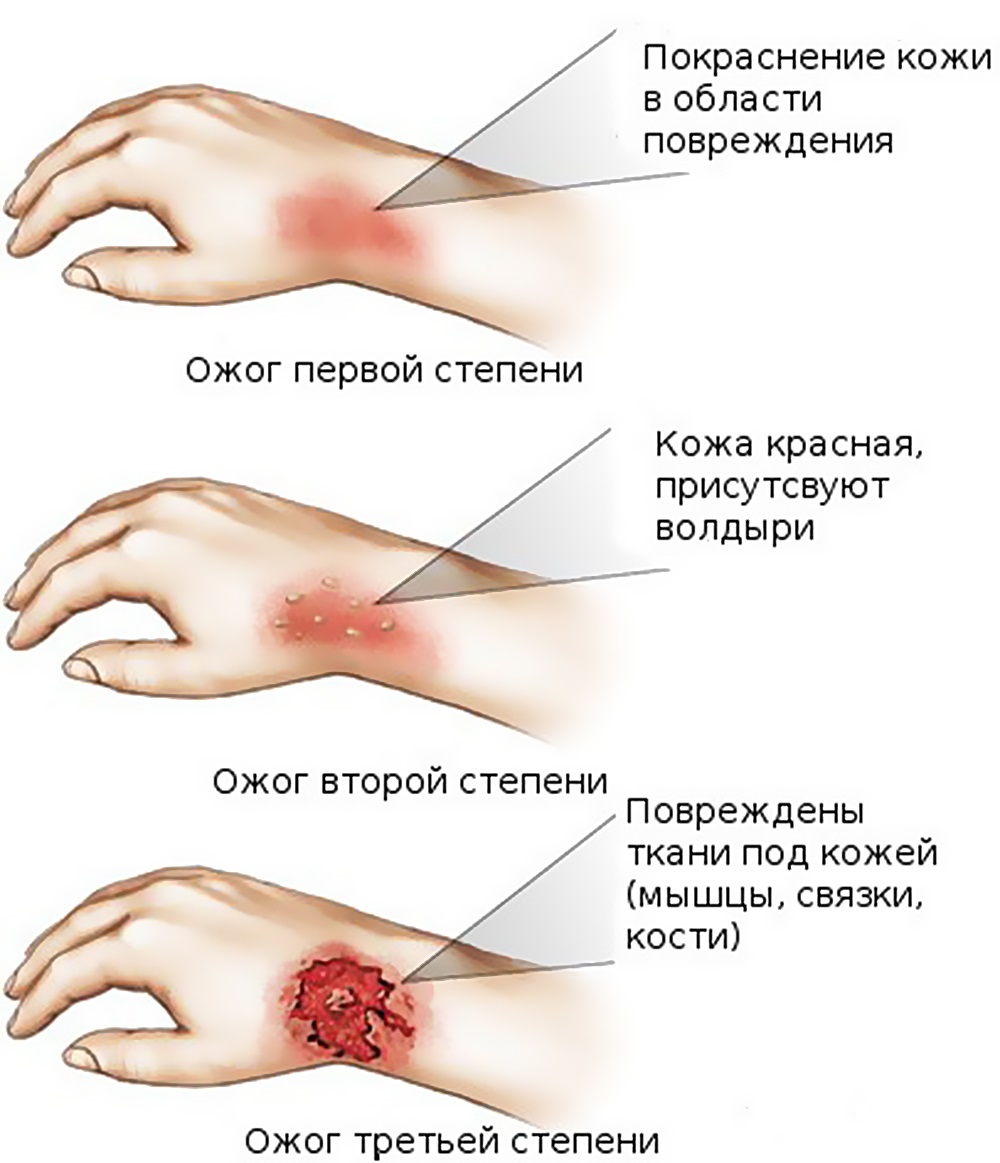 Когда обратиться к врачу