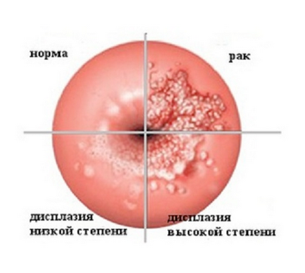 2. Хирургическое вмешательство