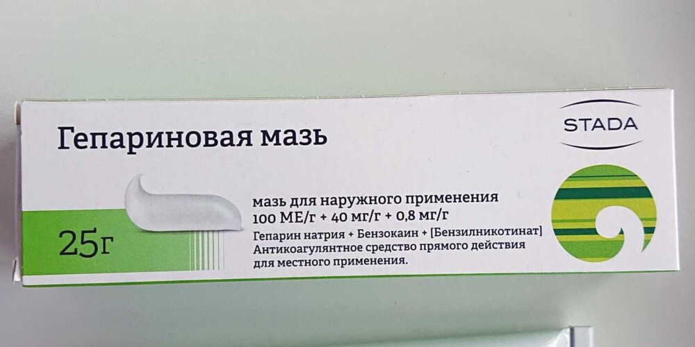 Что такое варикоз вен