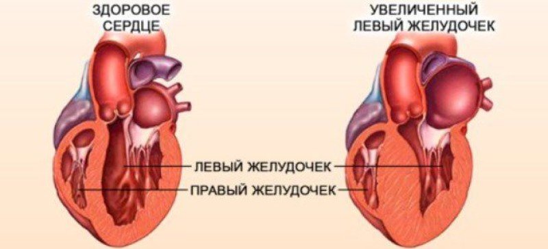 1. Лекарственная терапия