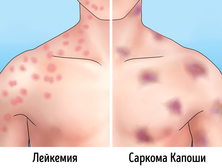 Характеристики течения заболевания