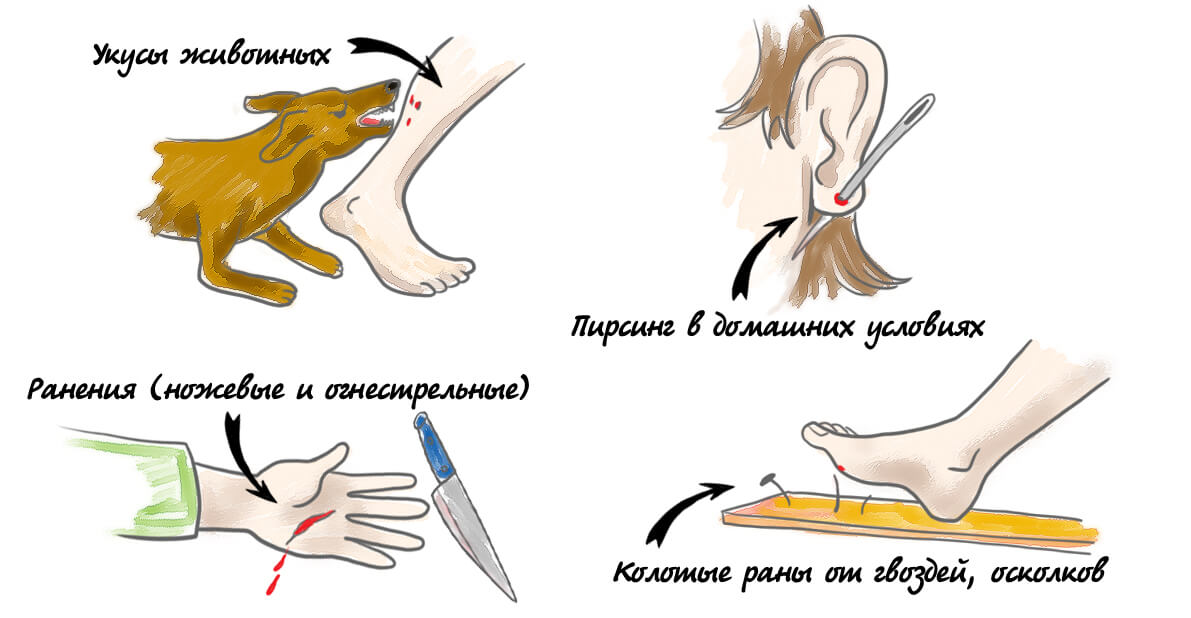 Непосредственный контакт с грунтом