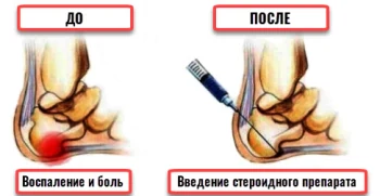 2. Избегание нагрузки