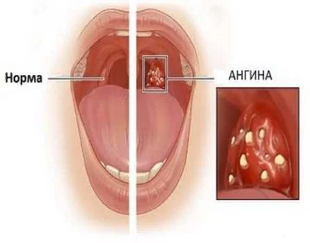Функции гланд