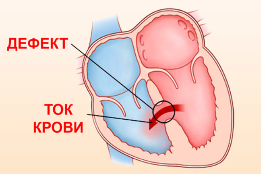 Обзор основных методов диагностики врожденных пороков сердца у детей
